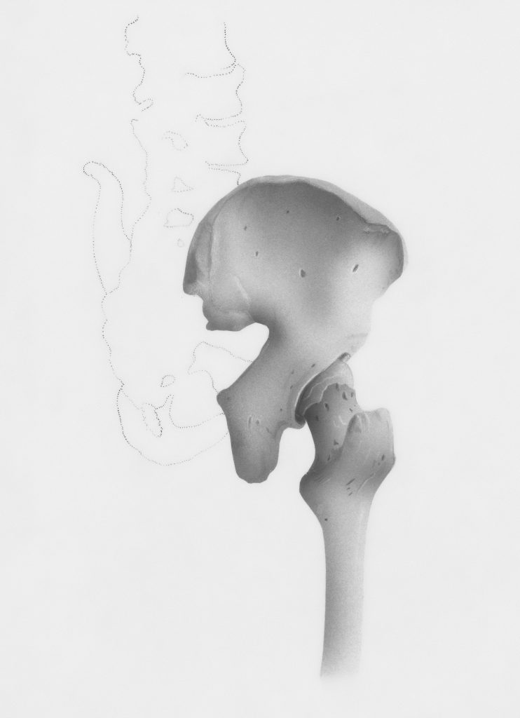 Femur